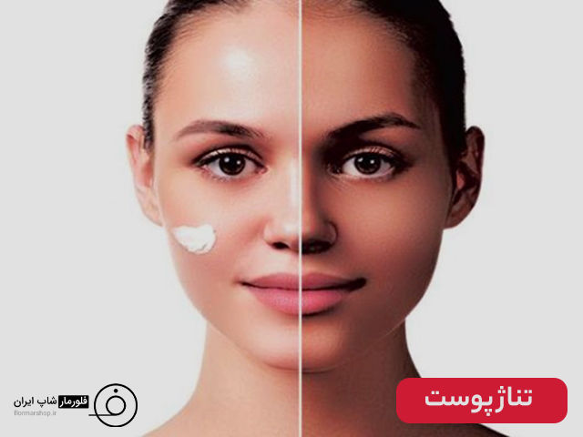 تناژ پوست چیست؟ + به همراه نکات کلیدی مهم